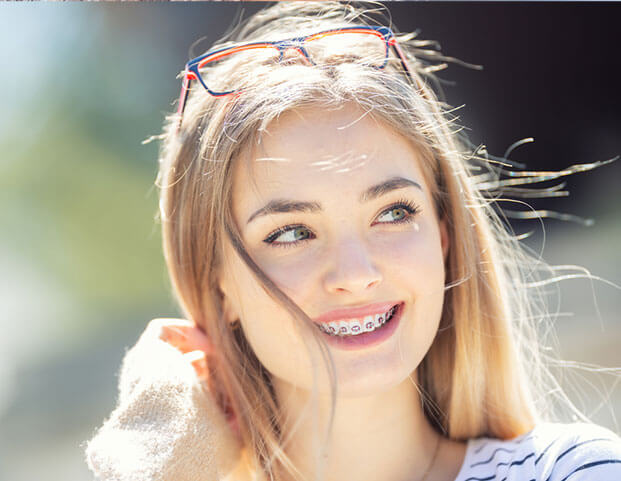 Metal braces Metal braces