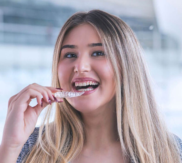 Benefits of Angel Aligners