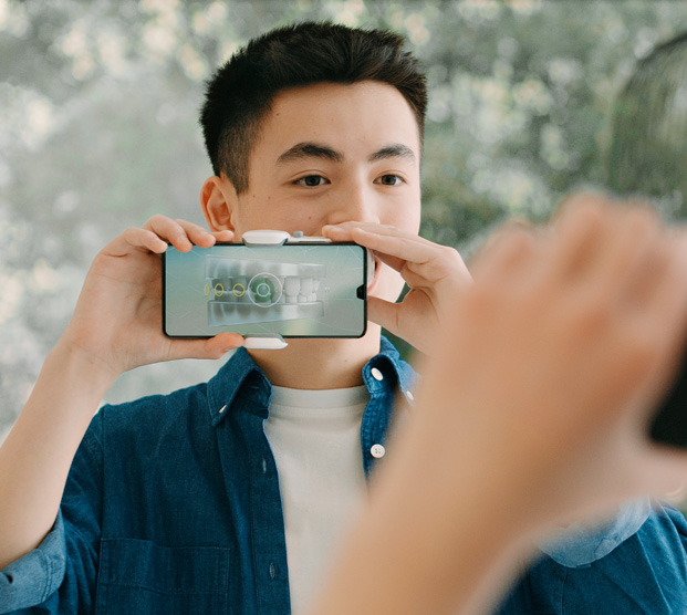 Spark aligners and Dental Monitoring - orthodontic care, anywhere