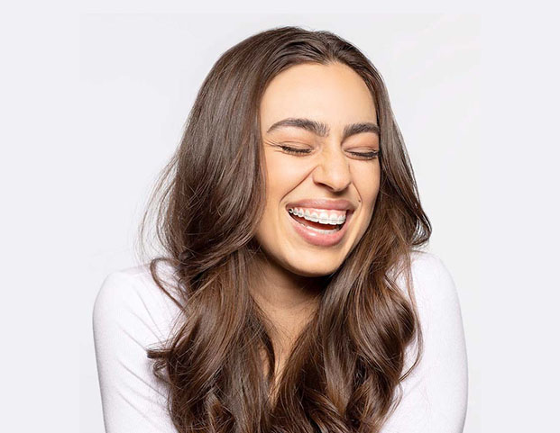 LightForce™ 3D braces LightForce™ 3D braces