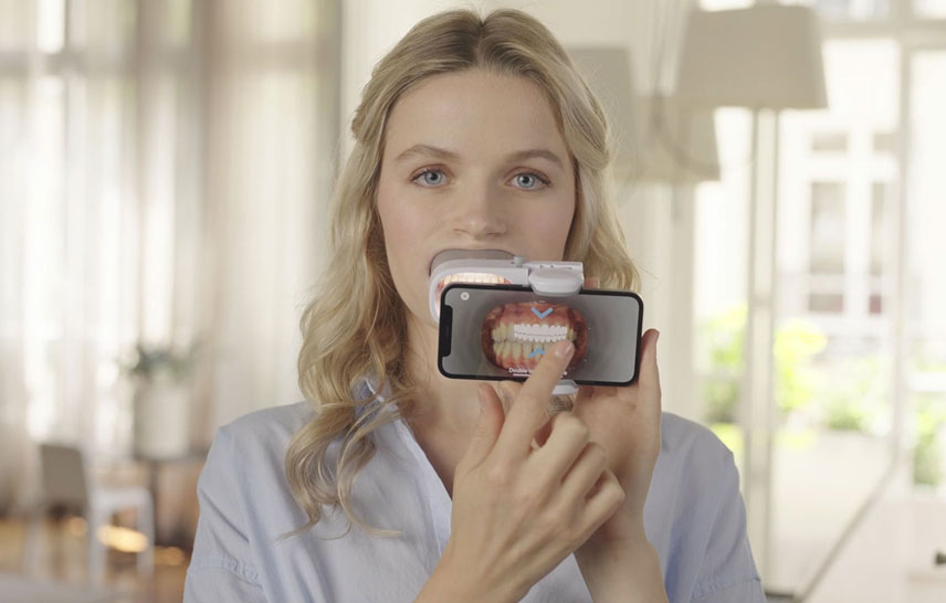 How Dental Monitoring keeps your orthodontic treatment on track How Dental Monitoring keeps your orthodontic treatment on track